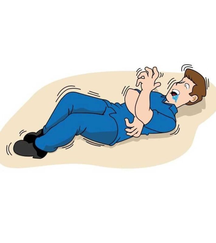 Bệnh động kinh - nguyên nhân, triệu chứng