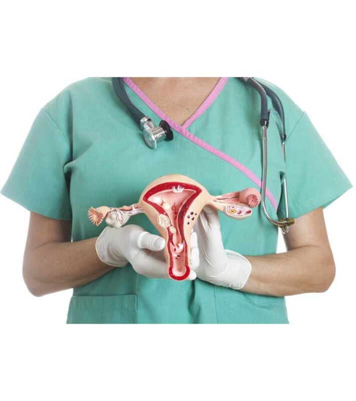 Ung thư cổ tử cung là gì?