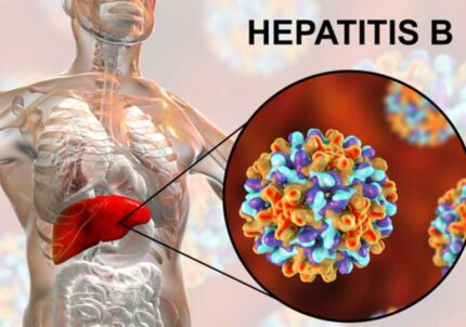 Những điều cần biết về Viêm gan B
