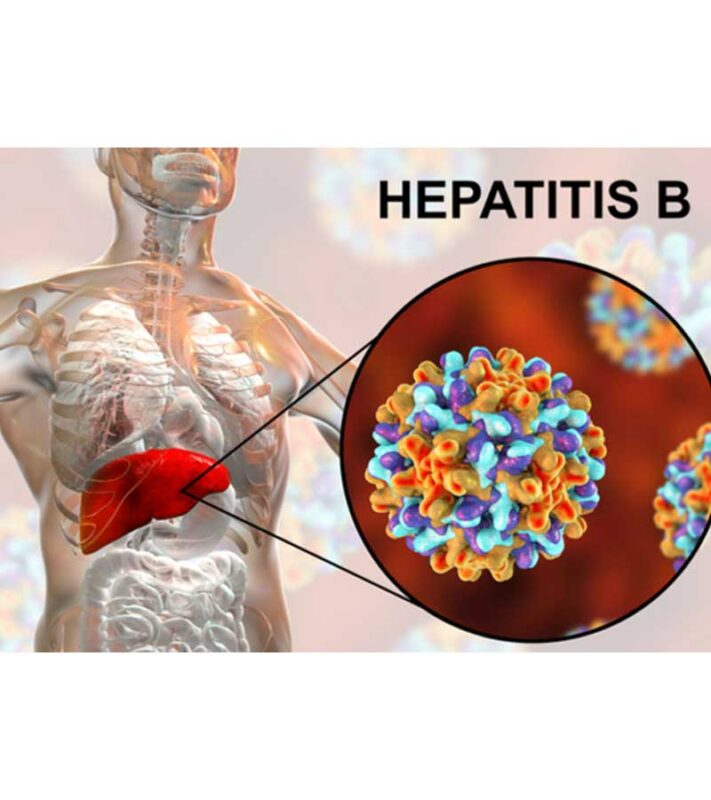 Những điều cần biết về Viêm gan B